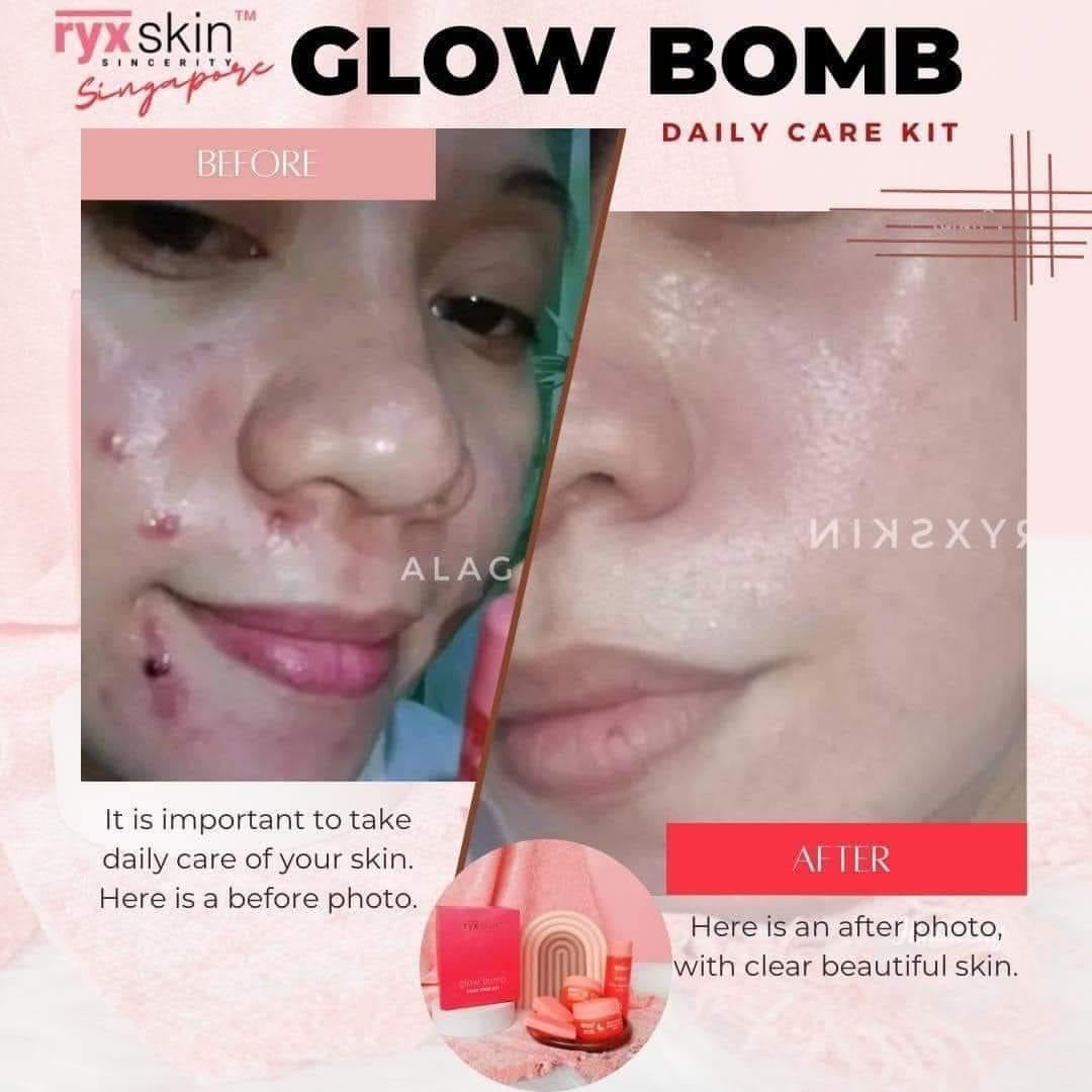 RYX Skin Glow Bomb Daily Care Kit - True Beauty Skin Essentials