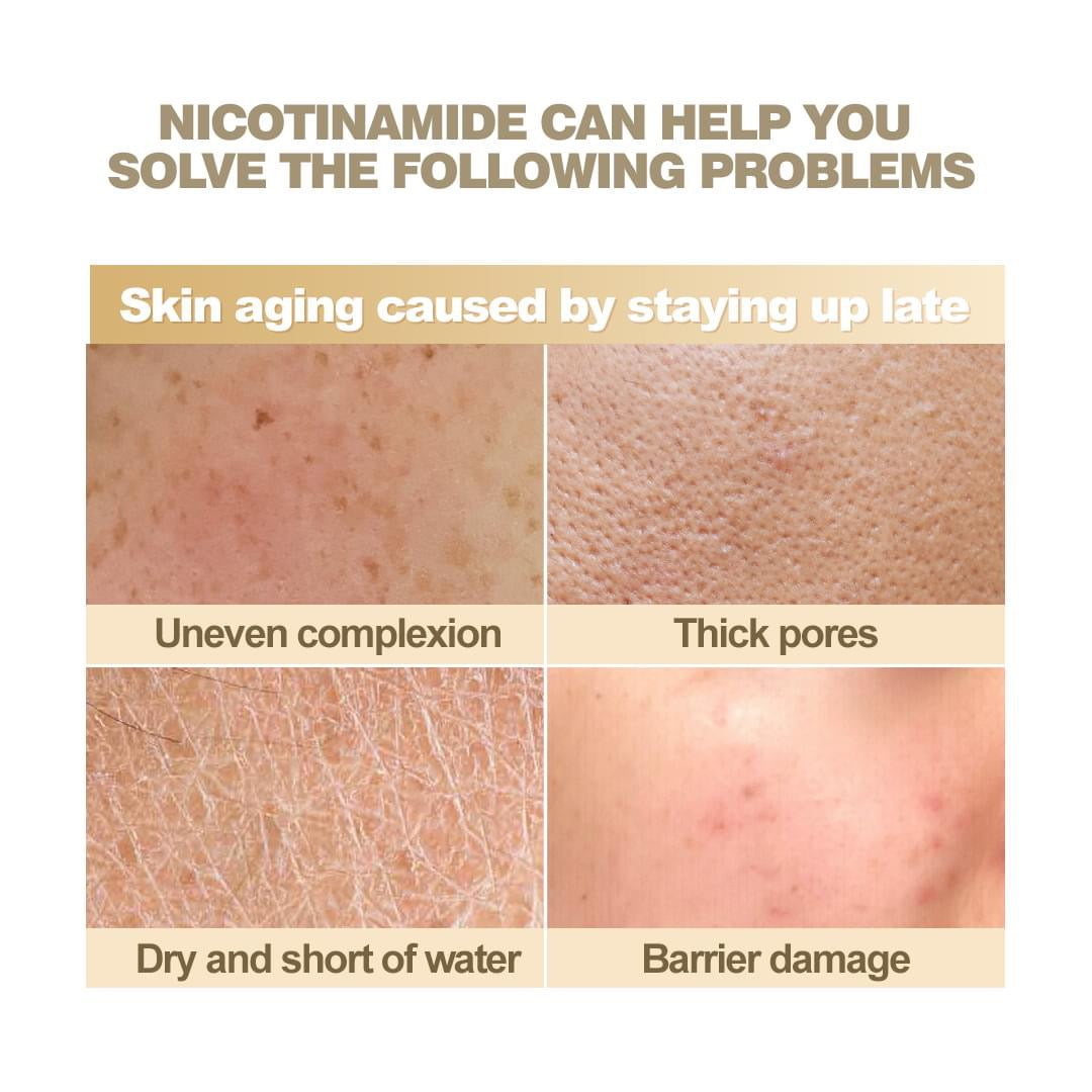 Ashley Shine Niacinamide Pure Serum - True Beauty Skin Essentials