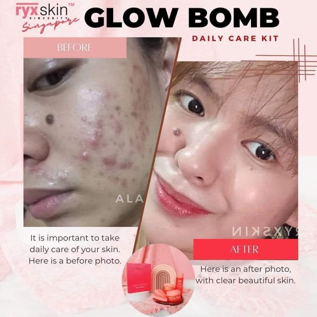 RYX Skin Glow Bomb Daily Care Kit - True Beauty Skin Essentials