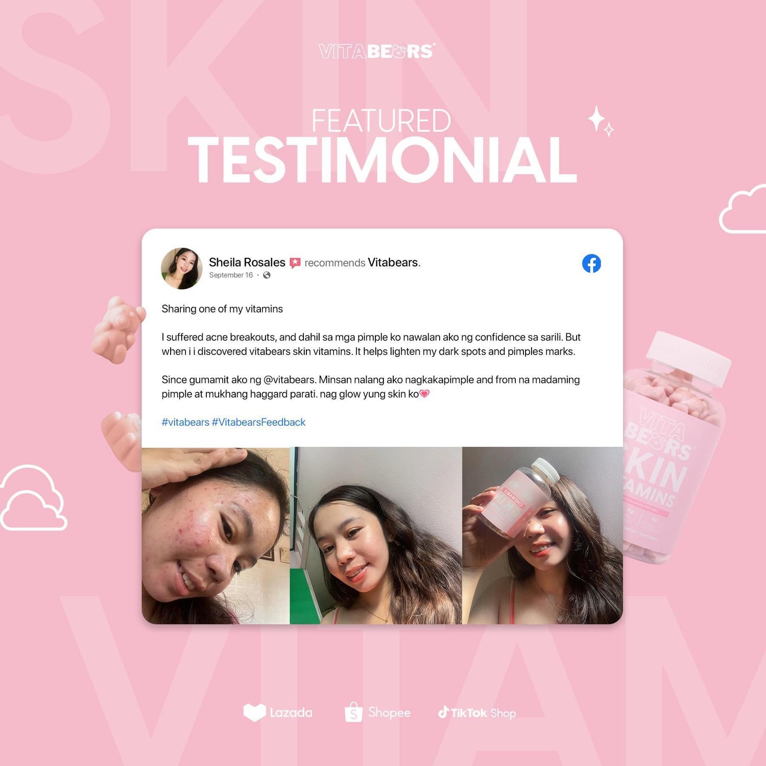 Vita Bears Vitamins - True Beauty Skin Essentials