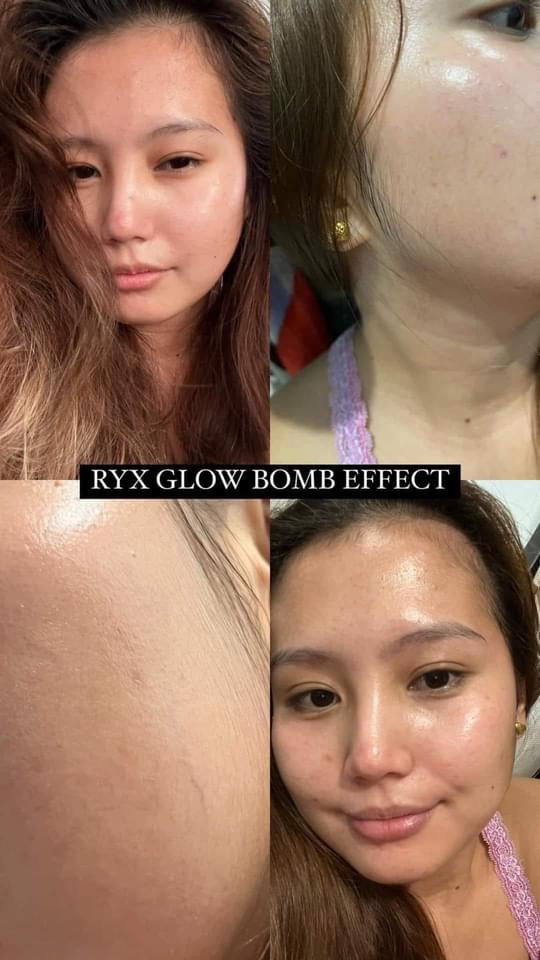 RYX Skin Glow Bomb Daily Care Kit - True Beauty Skin Essentials