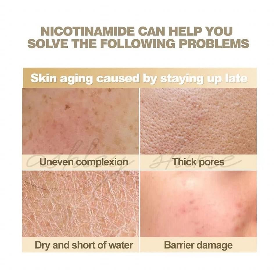 Ashley Shine Niacinamide Pure Serum - True Beauty Skin Essentials