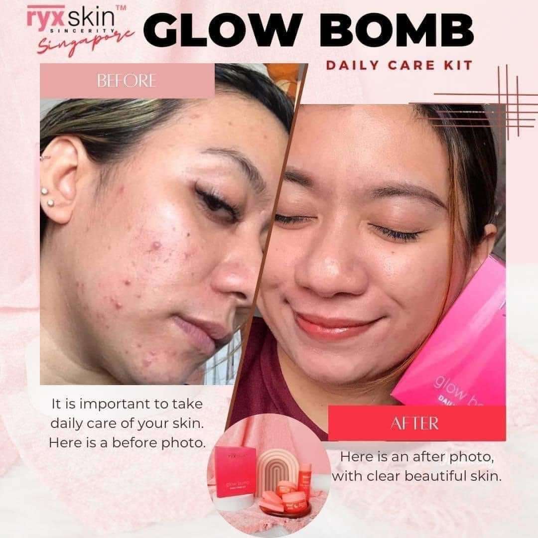 RYX Skin Glow Bomb Daily Care Kit - True Beauty Skin Essentials