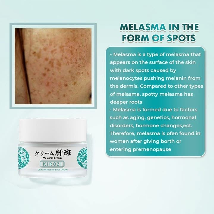 Dr Hancy White Spot Cream