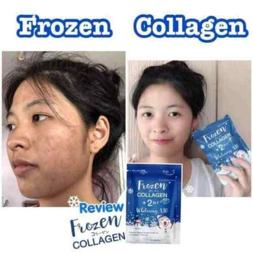 Frozen Collagen 2 in 1 Whitening 10x Glutathione - True Beauty Skin Essentials