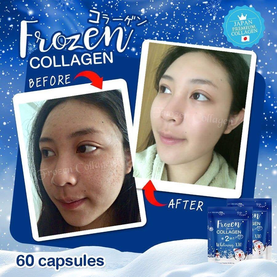 Frozen Collagen 2 in 1 Whitening 10x Glutathione - True Beauty Skin Essentials